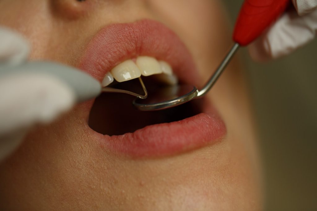 Больно ли удалять корень зуба?