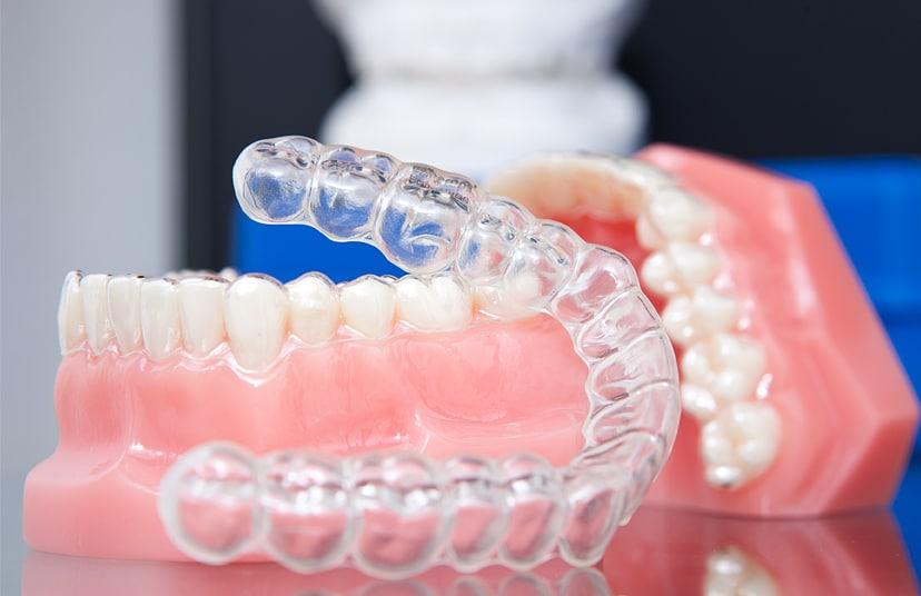 jpcrsfz1iri2kqi15l5n