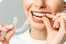 Элайнеры (каппы)